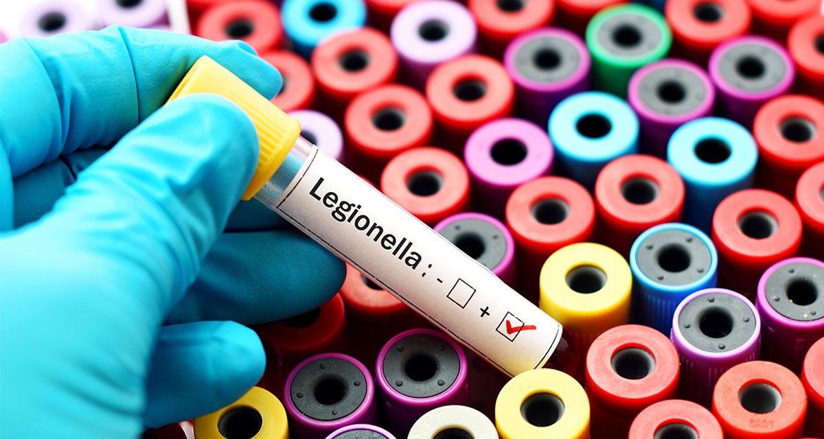 Legionella Management During Construction & Renovation